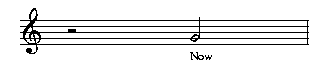 Picture of Mup output